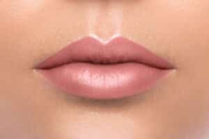 Close up of a woman's lips for lip lift surgery.